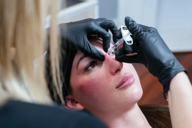 dr kate performing rhinoplasty with dermal fillers