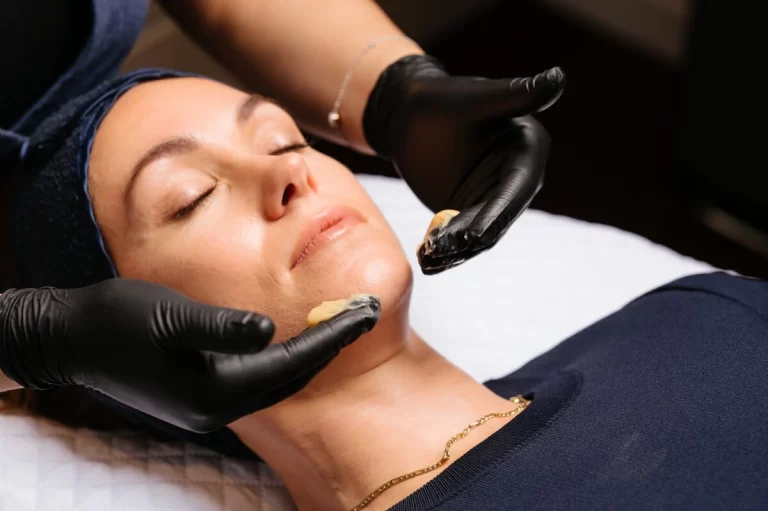 chemical peel being applied to treat skin condition