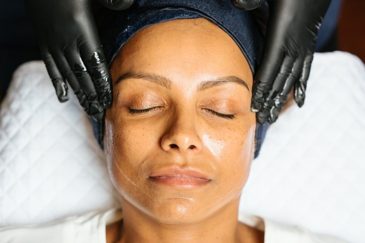 A Chemical Peel with an Additional Skin Treatment in Claremont