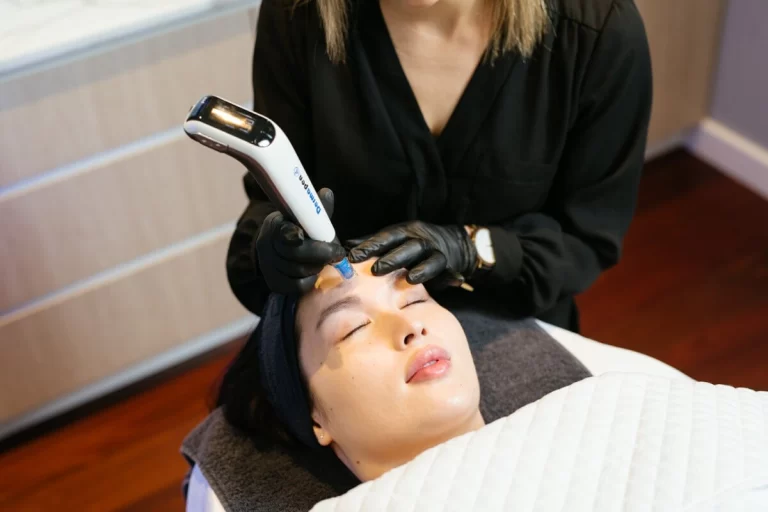 skin needling treatment with dermapen4