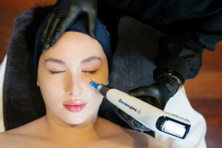 skin needling with dermapen4