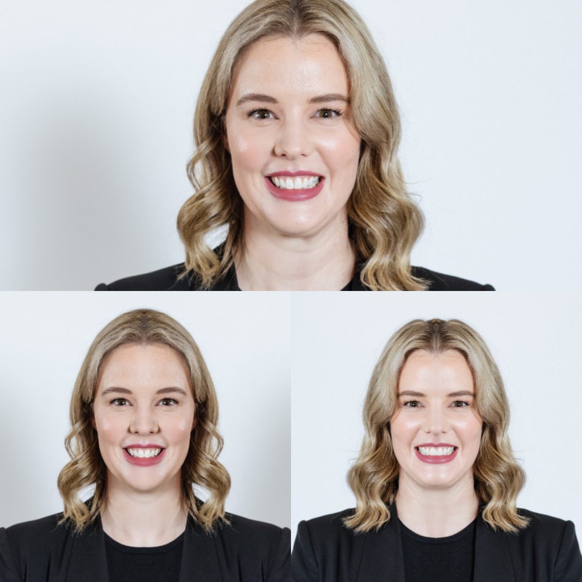 Fixing Facial Asymmetry Must Read Guide 