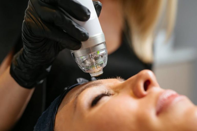 Intensif RF Microneedling Youth Lab, West Perth