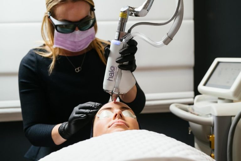 Halo Fractionated Laser Resurfacing Youth Lab, Perth